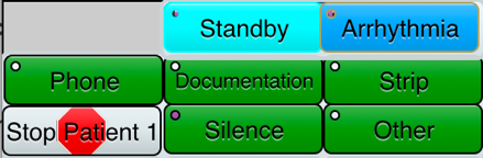 Figure 4. Alarm type (top) and monitor watcher responses (bottom, green) for a patient whose warning alarm went off. Figure 4. Alarm type (top) and monitor watcher responses (bottom, green) for a patient whose warning alarm went off.